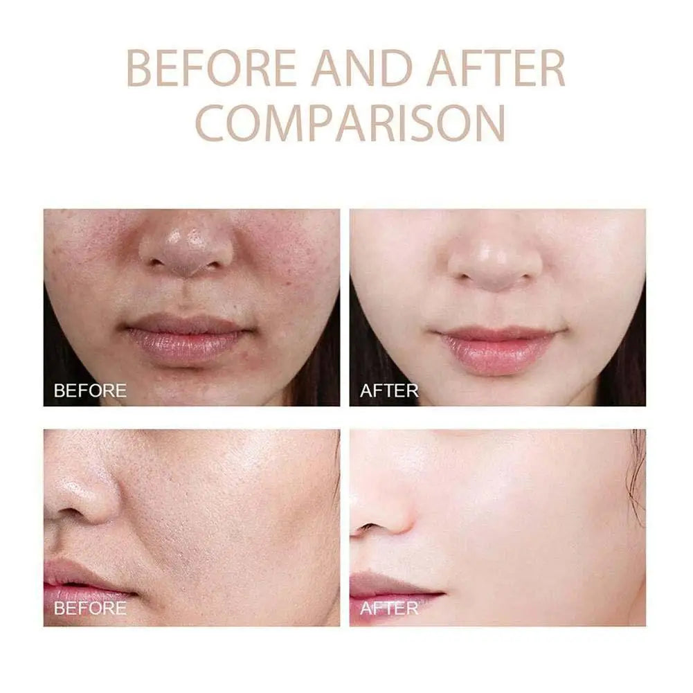 Dr. Melaxin Rice Exfoliating Serum Blackhead Removal Hydrating Pore Shrinking Repairing Skin Barrier Korean Moisturizing Essence