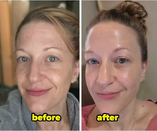 Dr Melaxin™ Rice Peel Shot Ampoule