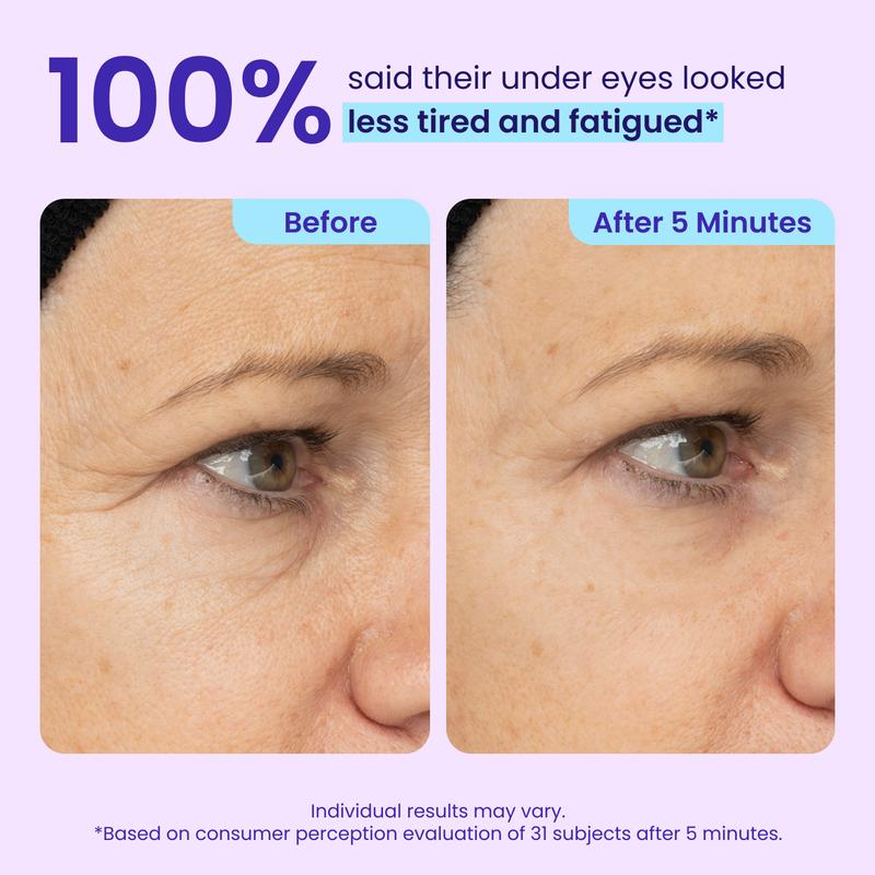 Instant Lift Eye Gel