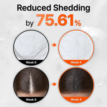 GrowTurn™ Korean Hair Growth Serum