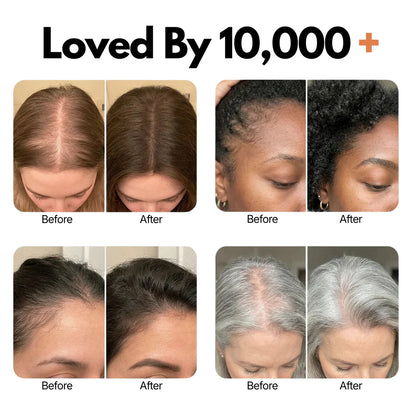 GrowTurn™ Korean Hair Growth Serum