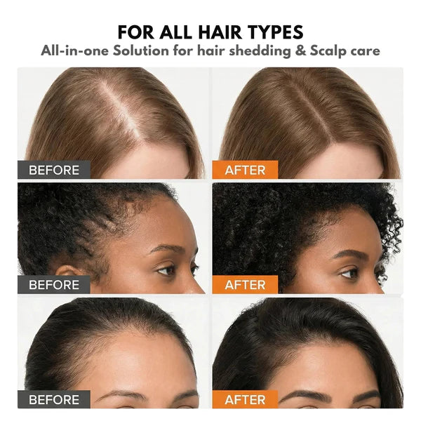 GrowTurn™ Korean Hair Growth Serum