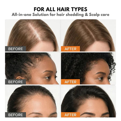 GrowTurn™ Korean Hair Growth Serum